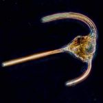 microscopic view of single dinoflagellate on black background